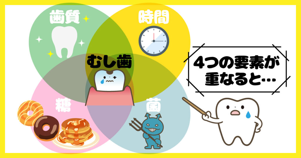 むし歯につながる4つの要素